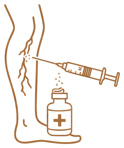 Escleroterapia para vasinhos com tecnologia de visualização venosa