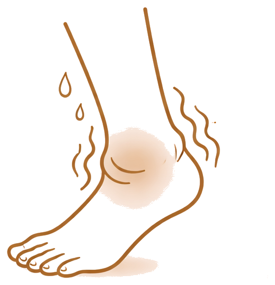 Ícone ilustrativo sobre inchaço nas pernas